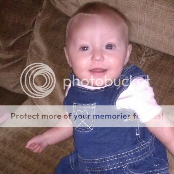 how to tell if baby has drooping eyelid. BabyCenter